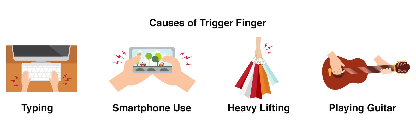 causes of trigger finger include typing, smartphone use, heavy lifting, and playing guitar